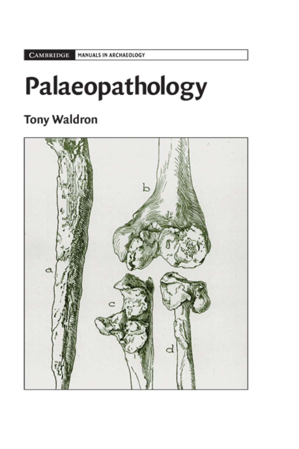 Palaeopathology 1st Edition â€“ PDF/EPUB Version Downloadable
