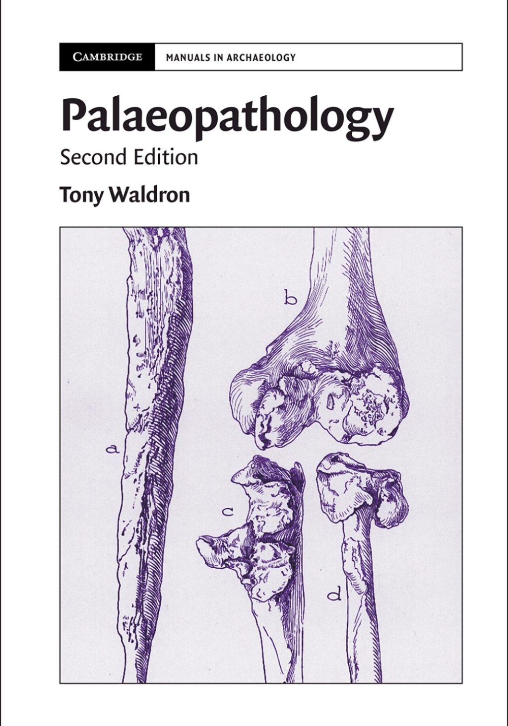 Palaeopathology 2nd Edition â€“ PDF/EPUB Version Downloadable