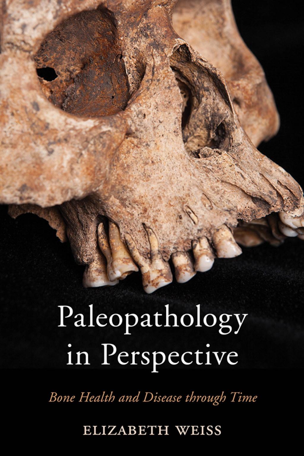 Paleopathology in Perspective Bone Health and Disease through Time 1st Edition â€“ PDF/EPUB Version Downloadable