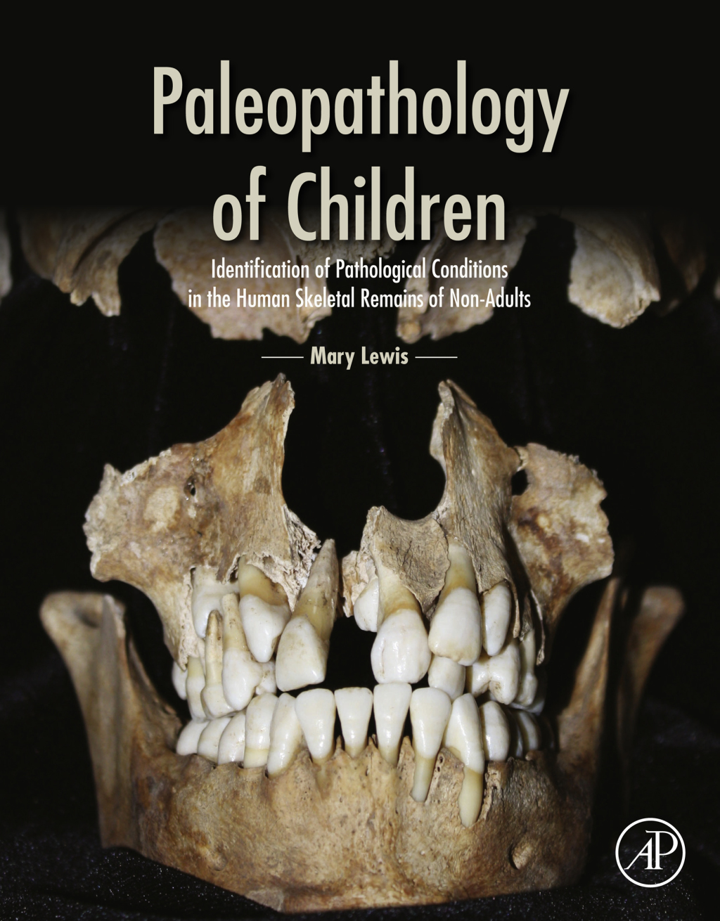 Paleopathology of Children Identification of Pathological Conditions in the Human Skeletal Remains of Non-Adults  â€“ PDF/EPUB Version Downloadable