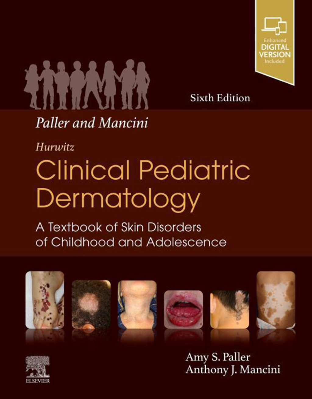 Paller and Mancini - Hurwitz Clinical Pediatric Dermatology A Textbook of Skin Disorders of Childhood and Adolescence 6th Edition â€“ PDF/EPUB Version Downloadable