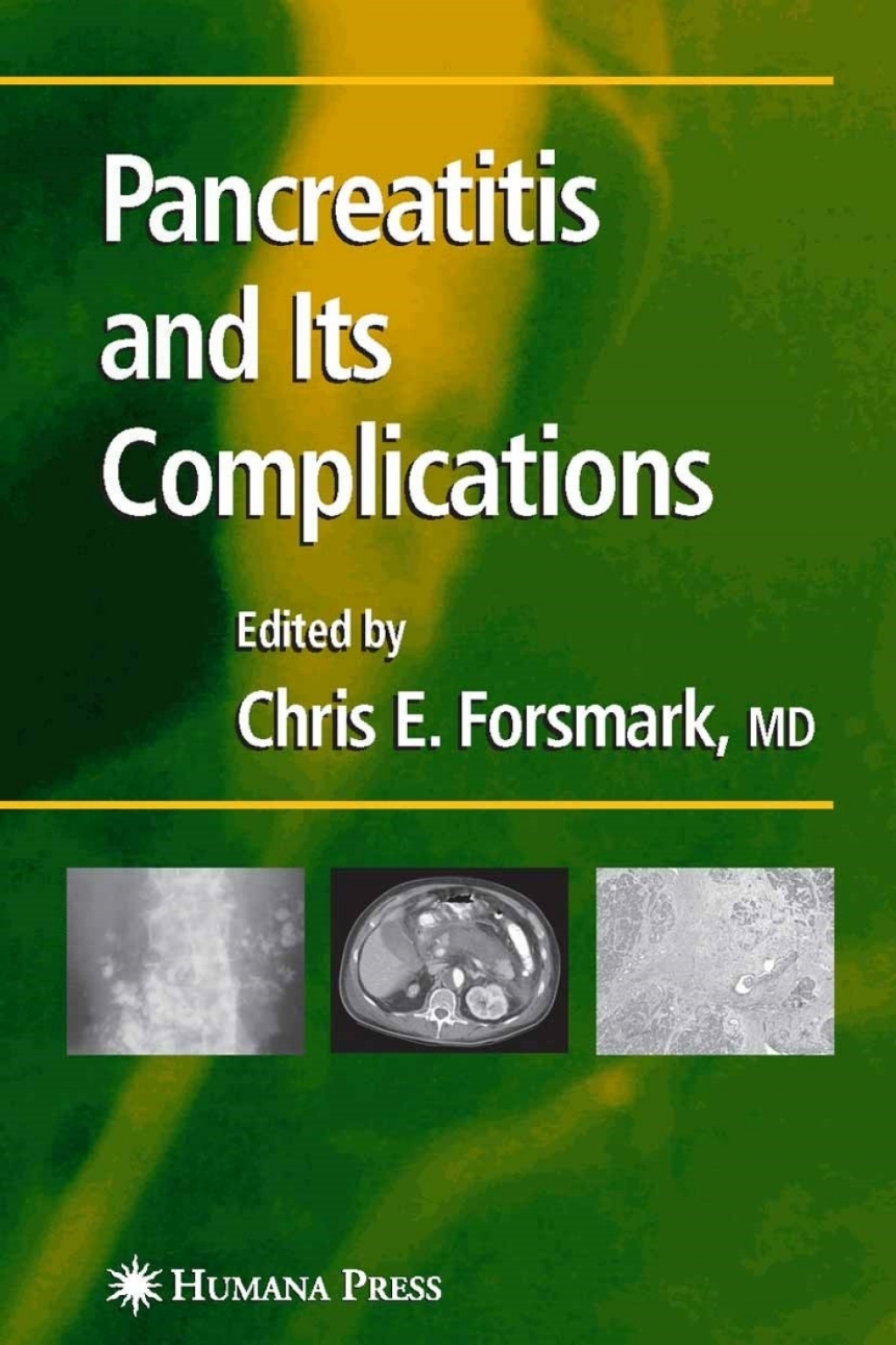 Pancreatitis and Its Complications 1st Edition â€“ PDF/EPUB Version Downloadable