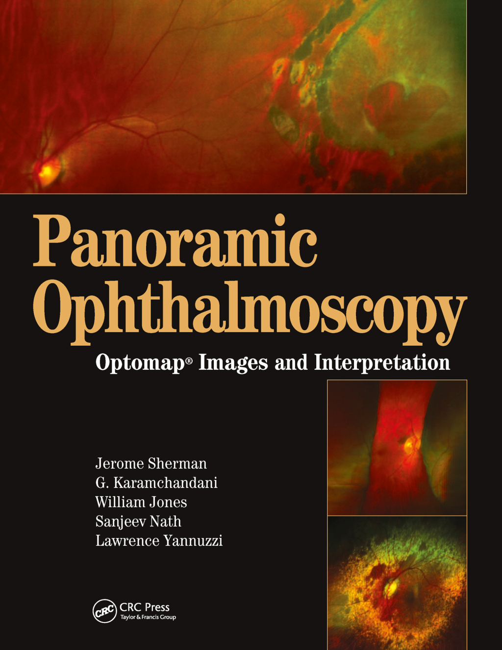 Panoramic Ophthalmoscopy Optomap Images and Interpretation 1st Edition â€“ PDF/EPUB Version Downloadable