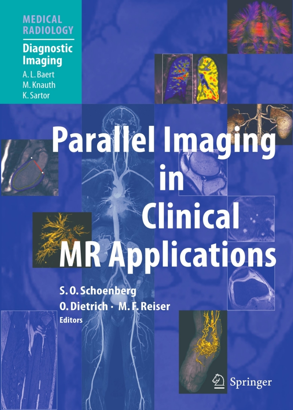 Parallel Imaging in Clinical MR Applications 1st Edition â€“ PDF/EPUB Version Downloadable