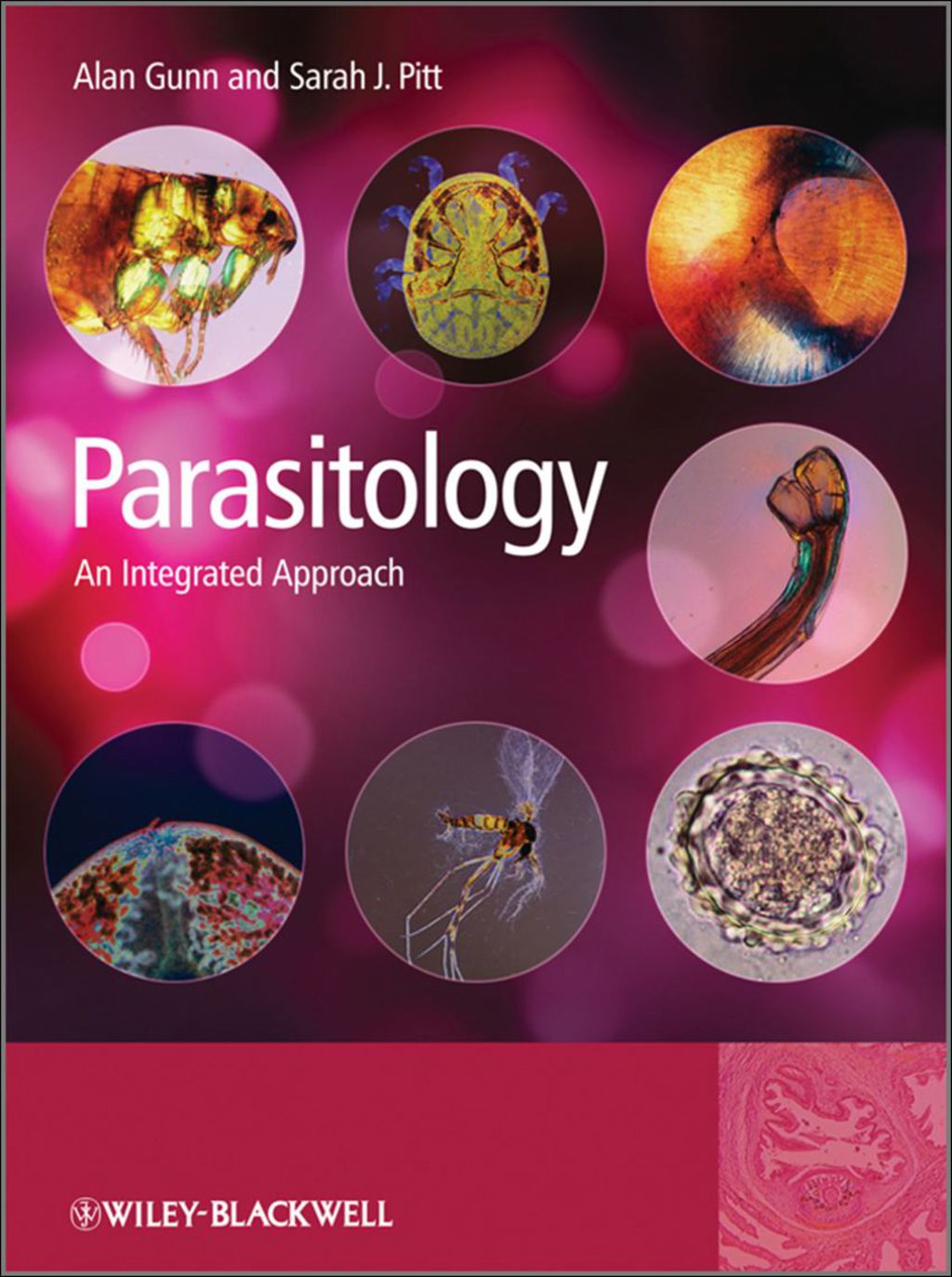 Parasitology 2nd Edition â€“ PDF/EPUB Version Downloadable