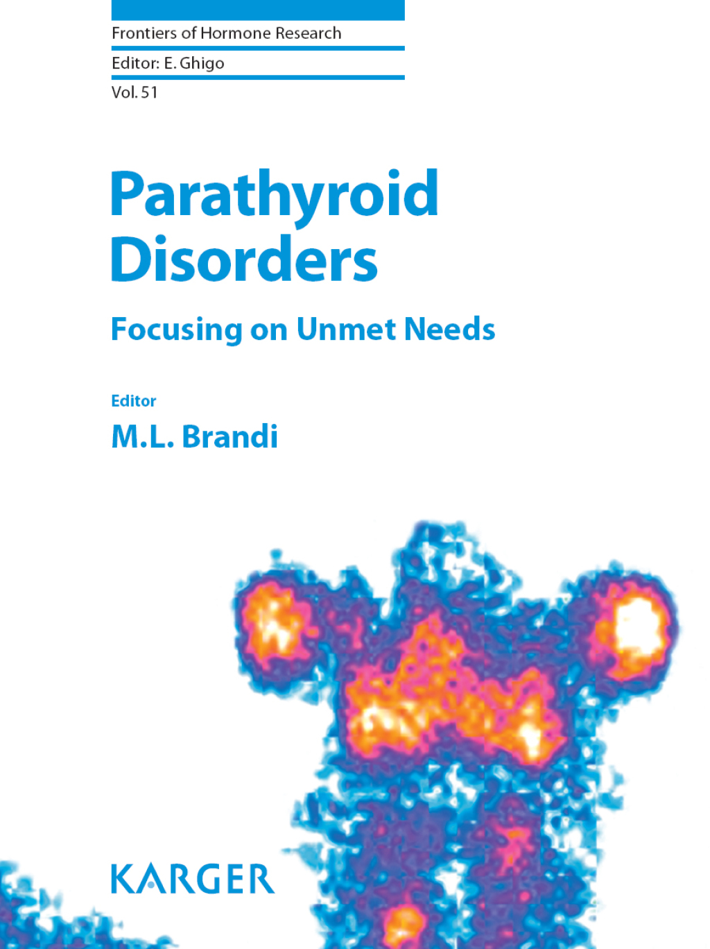 Parathyroid Disorders Focusing on Unmet Needs 1st Edition â€“ PDF/EPUB Version Downloadable