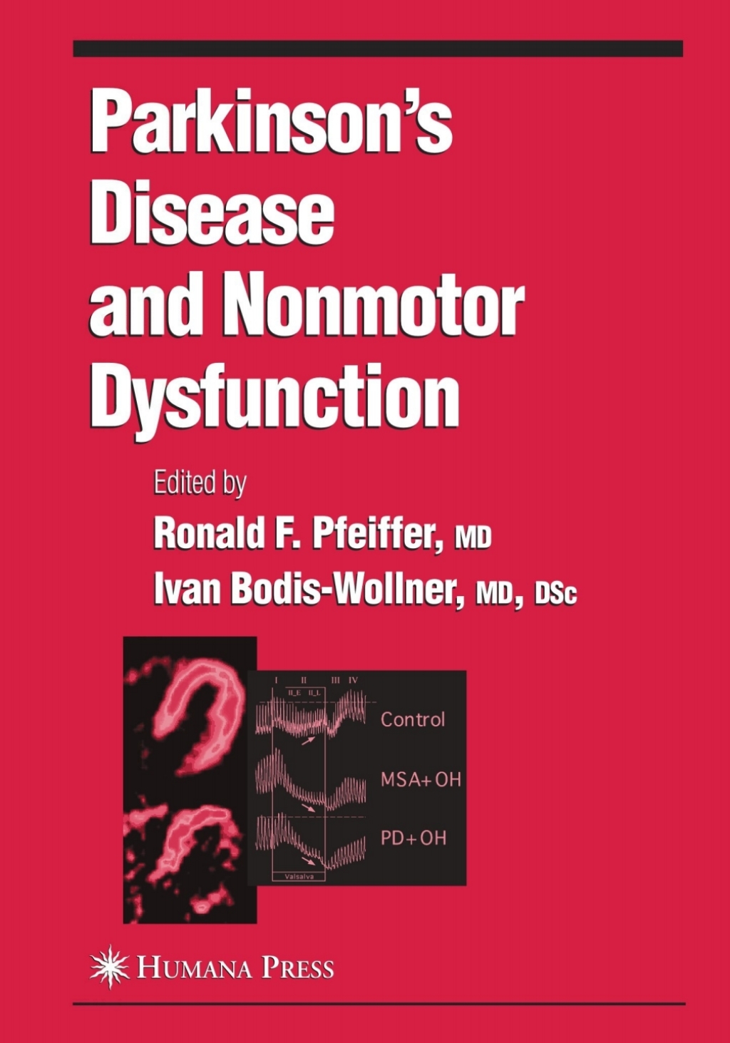 Parkinson's Disease and Nonmotor Dysfunction 1st Edition â€“ PDF/EPUB Version Downloadable