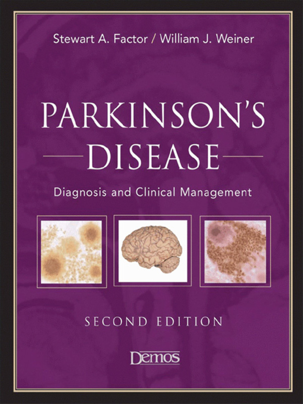 Parkinson's Disease Diagnosis and Clinical Management 2nd Edition â€“ PDF/EPUB Version Downloadable