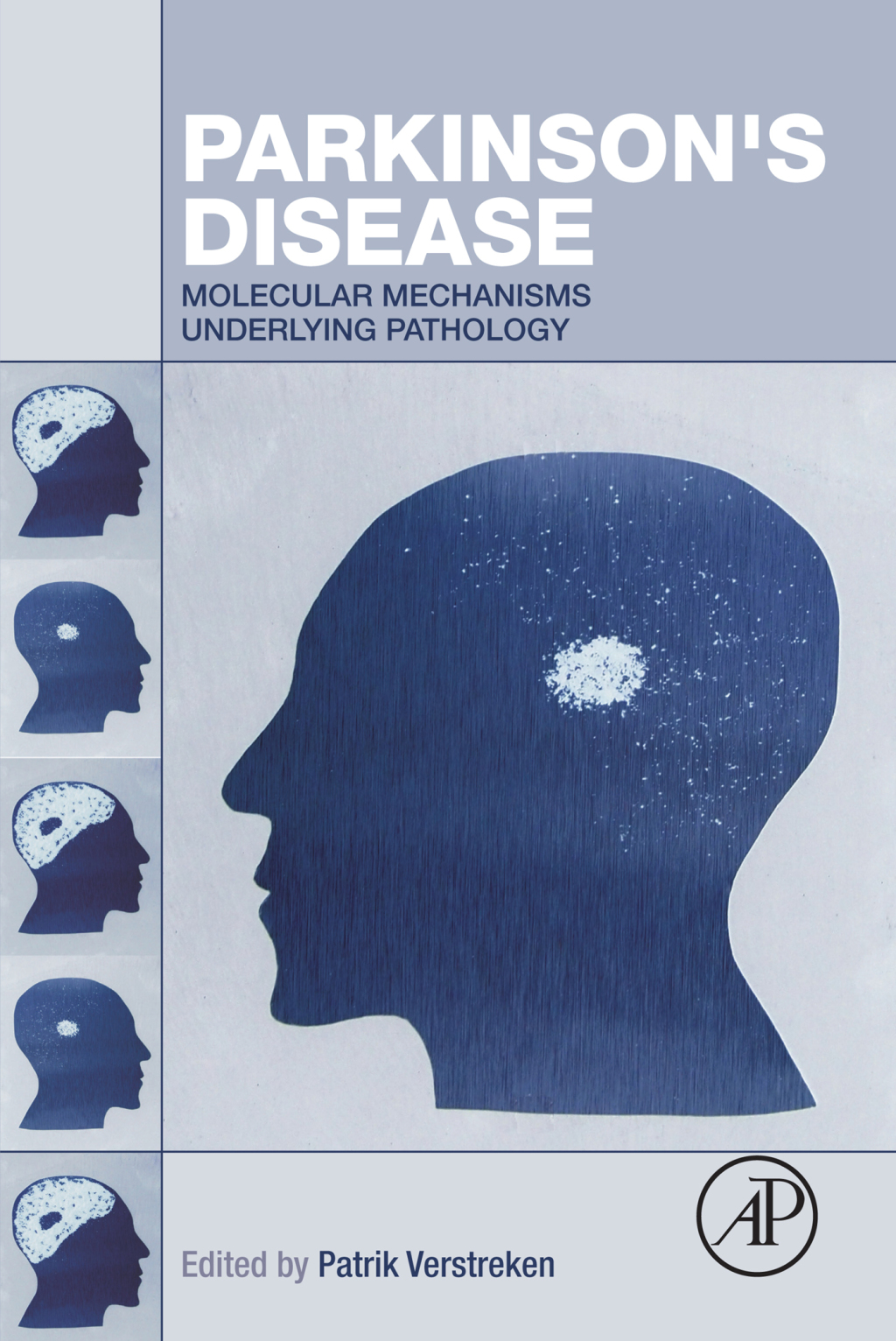 Parkinson's Disease Molecular Mechanisms Underlying Pathology  â€“ PDF/EPUB Version Downloadable