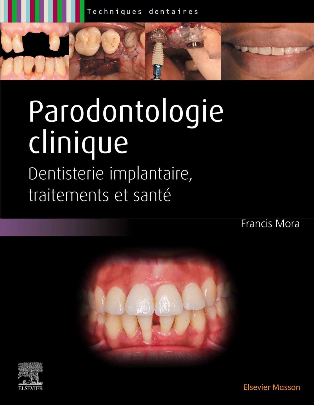 Parodontologie clinique Dentisterie implantaire, traitements et santÃ©  â€“ PDF/EPUB Version Downloadable