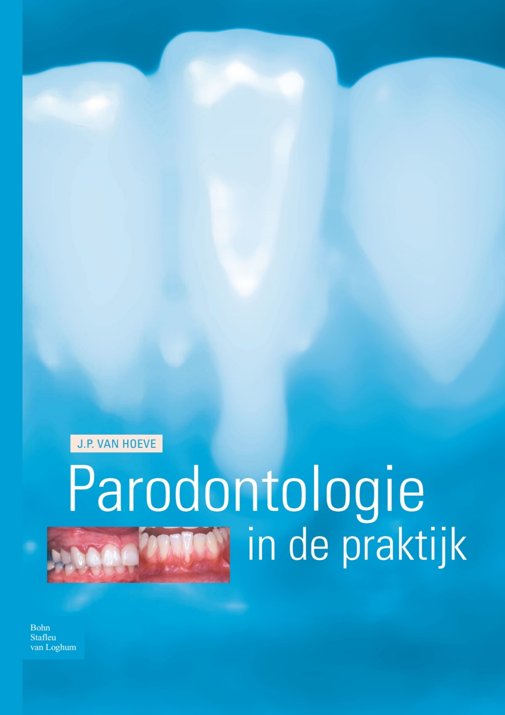 Parodontologie in de praktijk  â€“ PDF/EPUB Version Downloadable