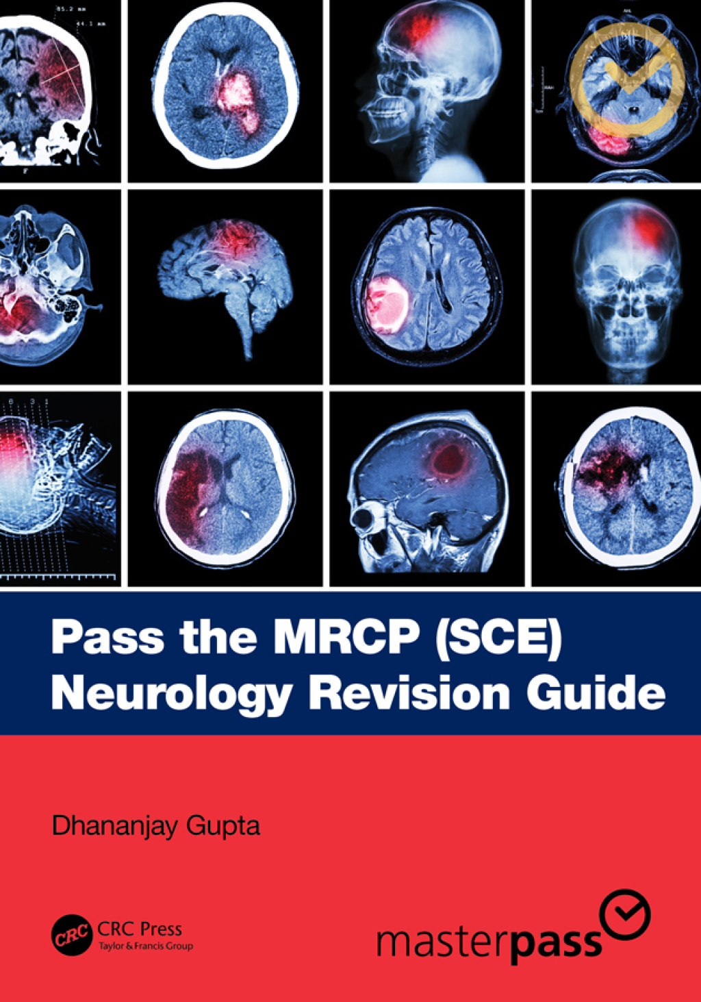 Pass the MRCP (SCE) Neurology Revision Guide 1st Edition â€“ PDF/EPUB Version Downloadable