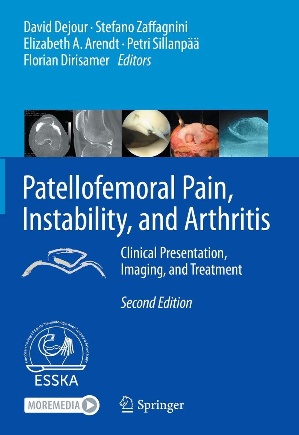 Patellofemoral Pain, Instability, and Arthritis Clinical Presentation, Imaging, and Treatment 2nd Edition â€“ PDF/EPUB Version Downloadable