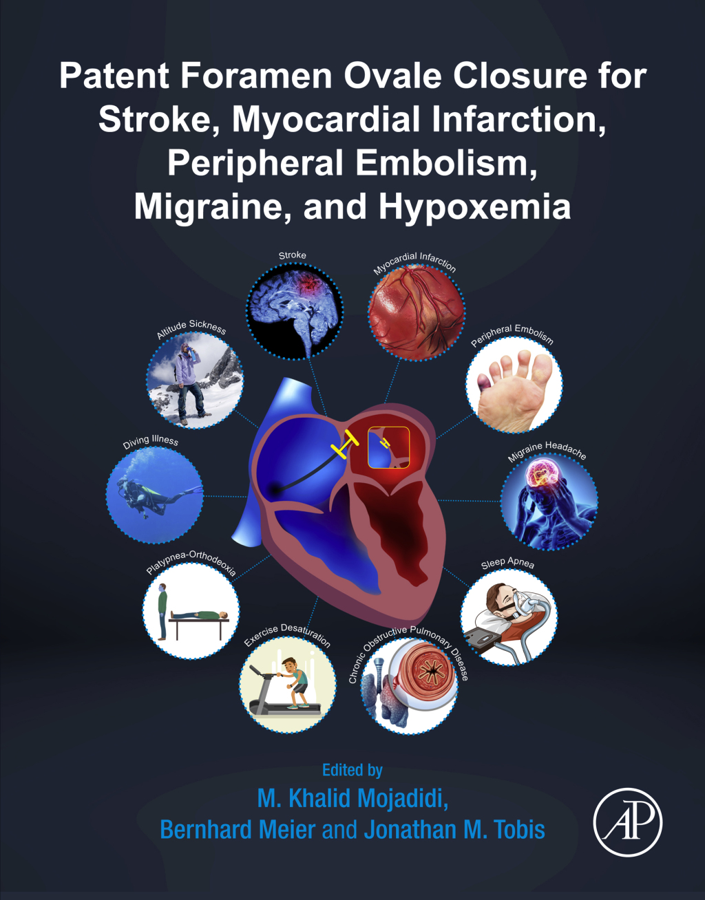 Patent Foramen Ovale Closure for Stroke, Myocardial Infarction, Peripheral Embolism, Migraine, and Hypoxemia  â€“ PDF/EPUB Version Downloadable