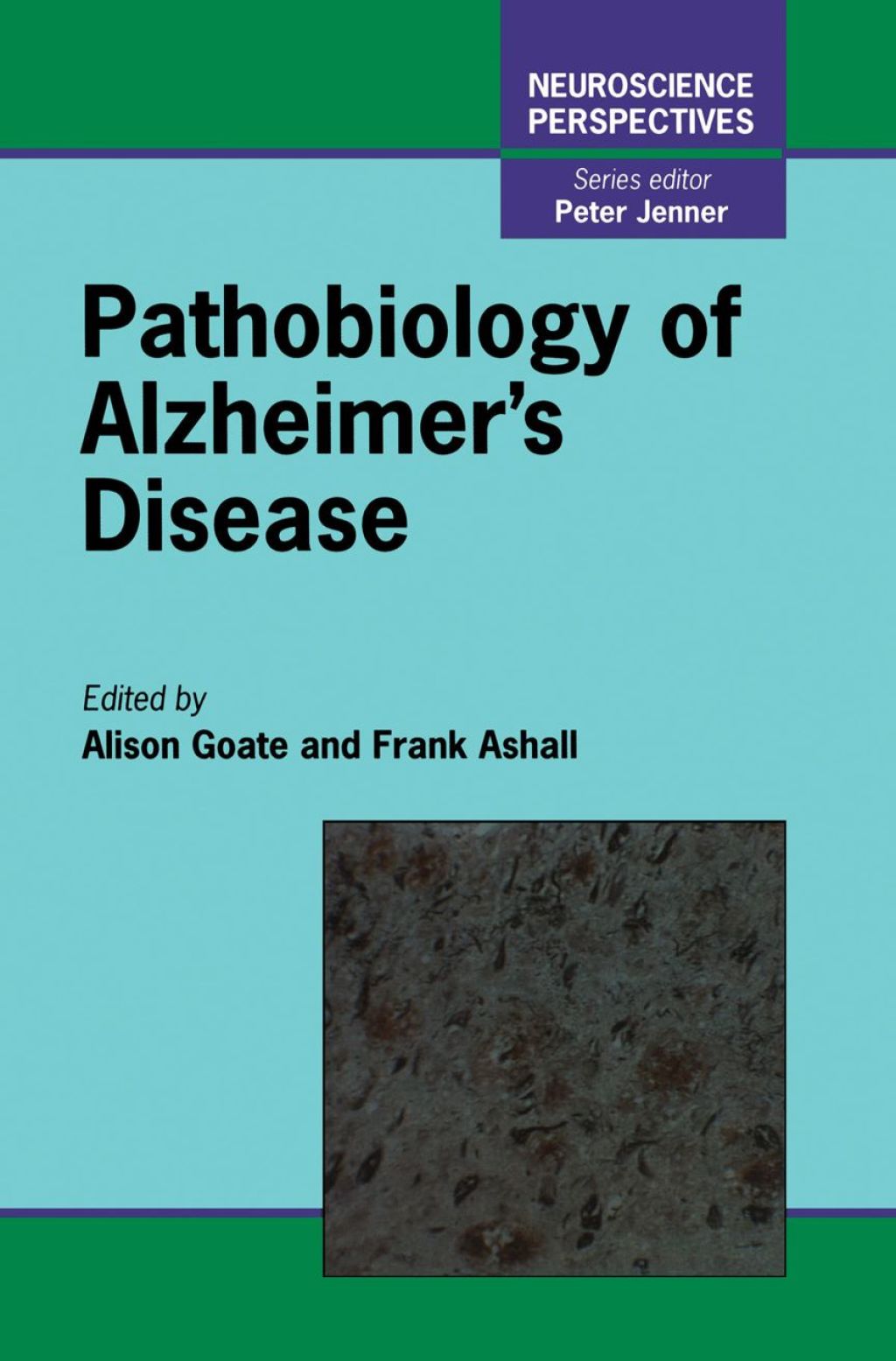 Pathobiology of Alzheimer's Disease  â€“ PDF/EPUB Version Downloadable