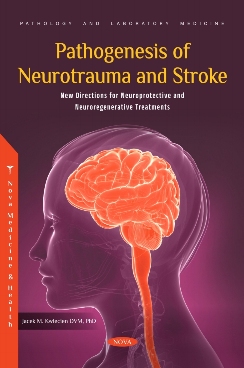 Pathogenesis of Neurotrauma and Stroke: New Directions for Neuroprotective and Neuroregenerative Treatments  â€“ PDF/EPUB Version Downloadable