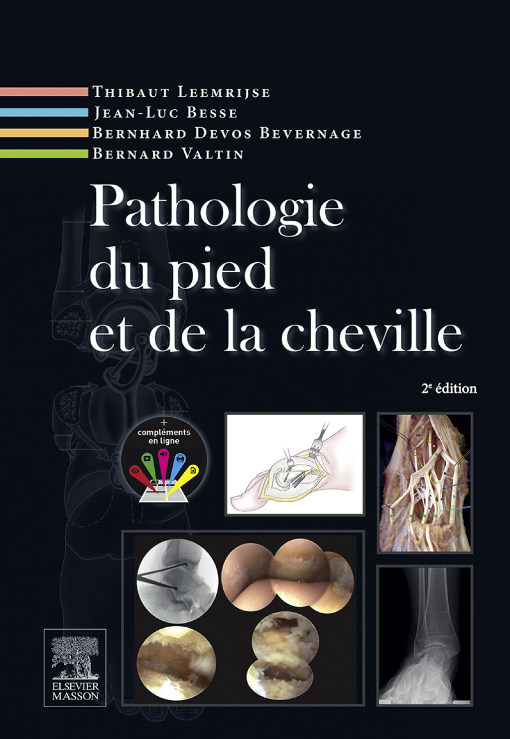 Pathologie du pied et de la cheville 2nd Edition â€“ PDF/EPUB Version Downloadable