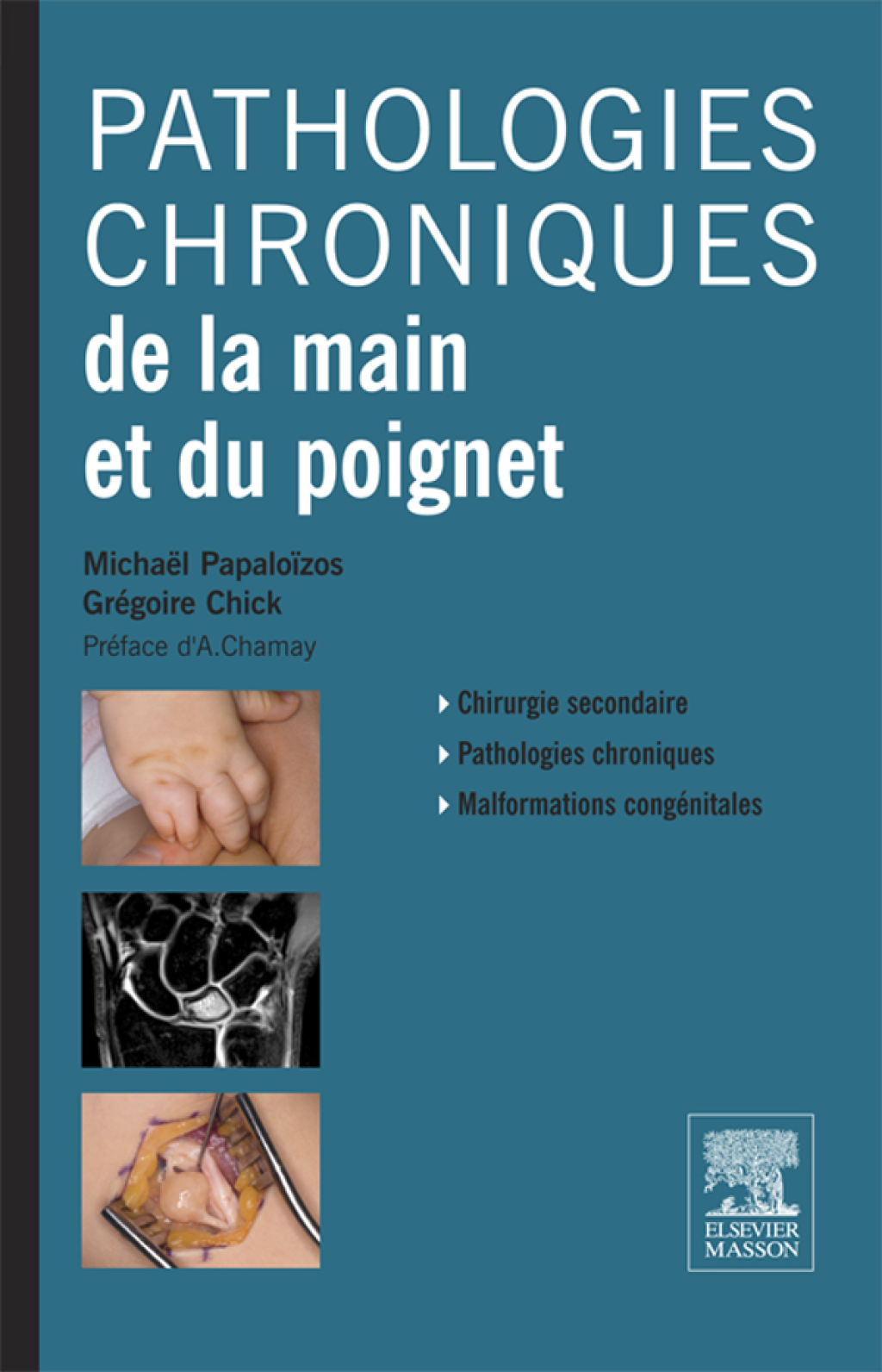 Pathologies chroniques de la main et du poignet  â€“ PDF/EPUB Version Downloadable