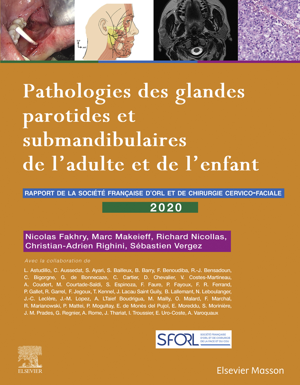 Pathologies des glandes parotides et submandibulaires de l'adulte et de l'enfant Rapport SFORL 2020  â€“ PDF/EPUB Version Downloadable