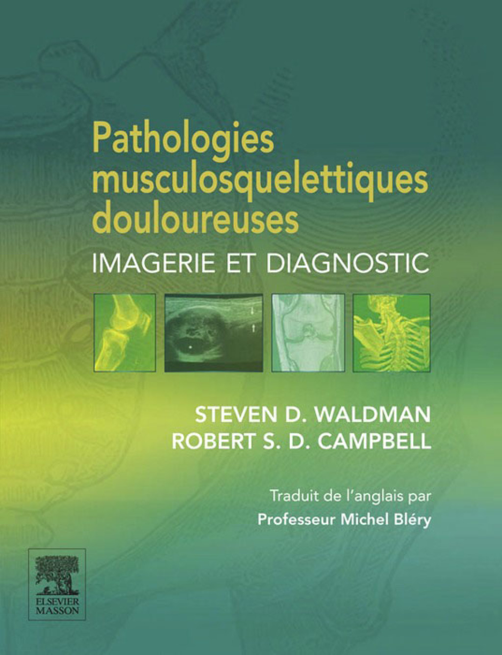 Pathologies musculosquelettiques douloureuses Imagerie et diagnostic  â€“ PDF/EPUB Version Downloadable