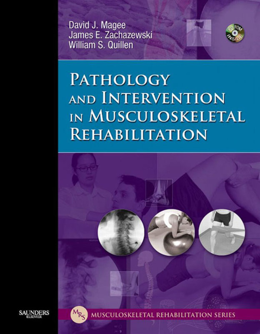 Pathology and Intervention in Musculoskeletal Rehabilitation  â€“ PDF/EPUB Version Downloadable