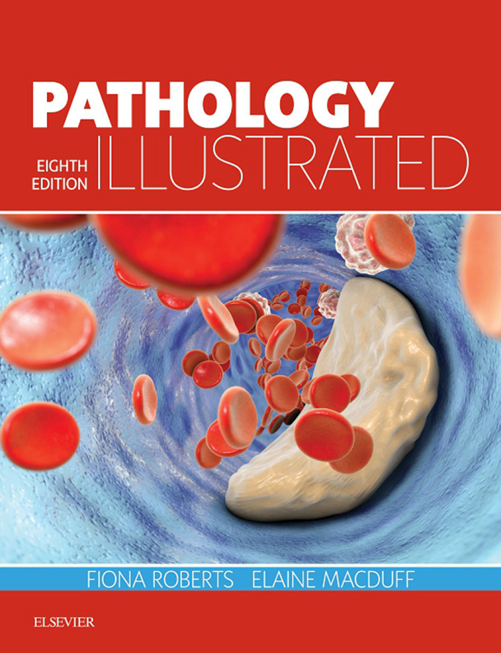 Pathology Illustrated 8th Edition â€“ PDF/EPUB Version Downloadable