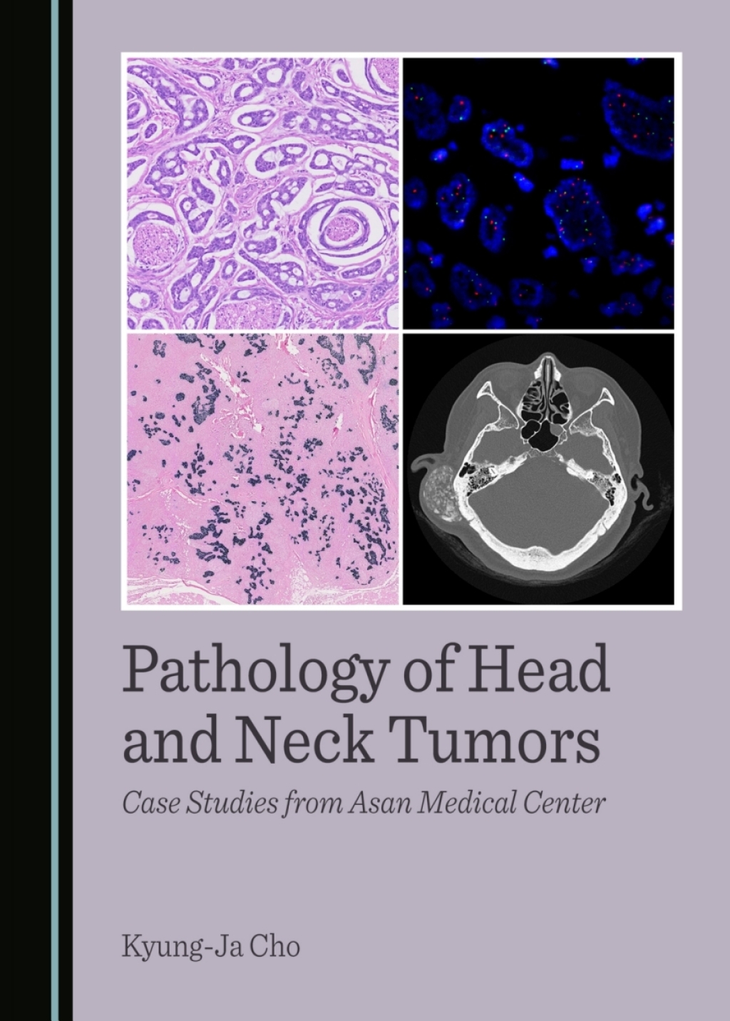 Pathology of Head and Neck Tumors Case Studies from Asan Medical Center 1st Edition â€“ PDF/EPUB Version Downloadable