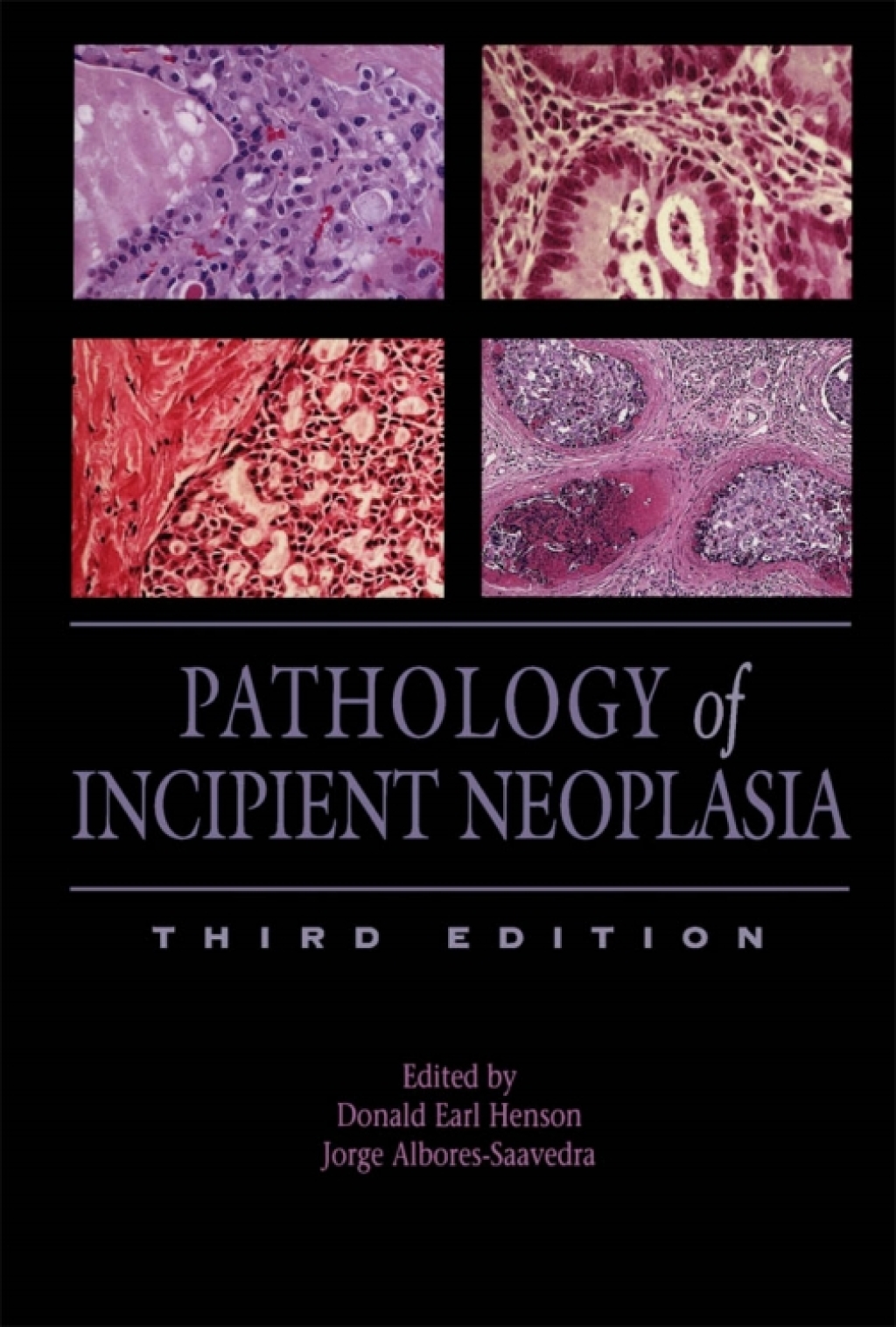 Pathology of Incipient Neoplasia 3rd Edition â€“ PDF/EPUB Version Downloadable