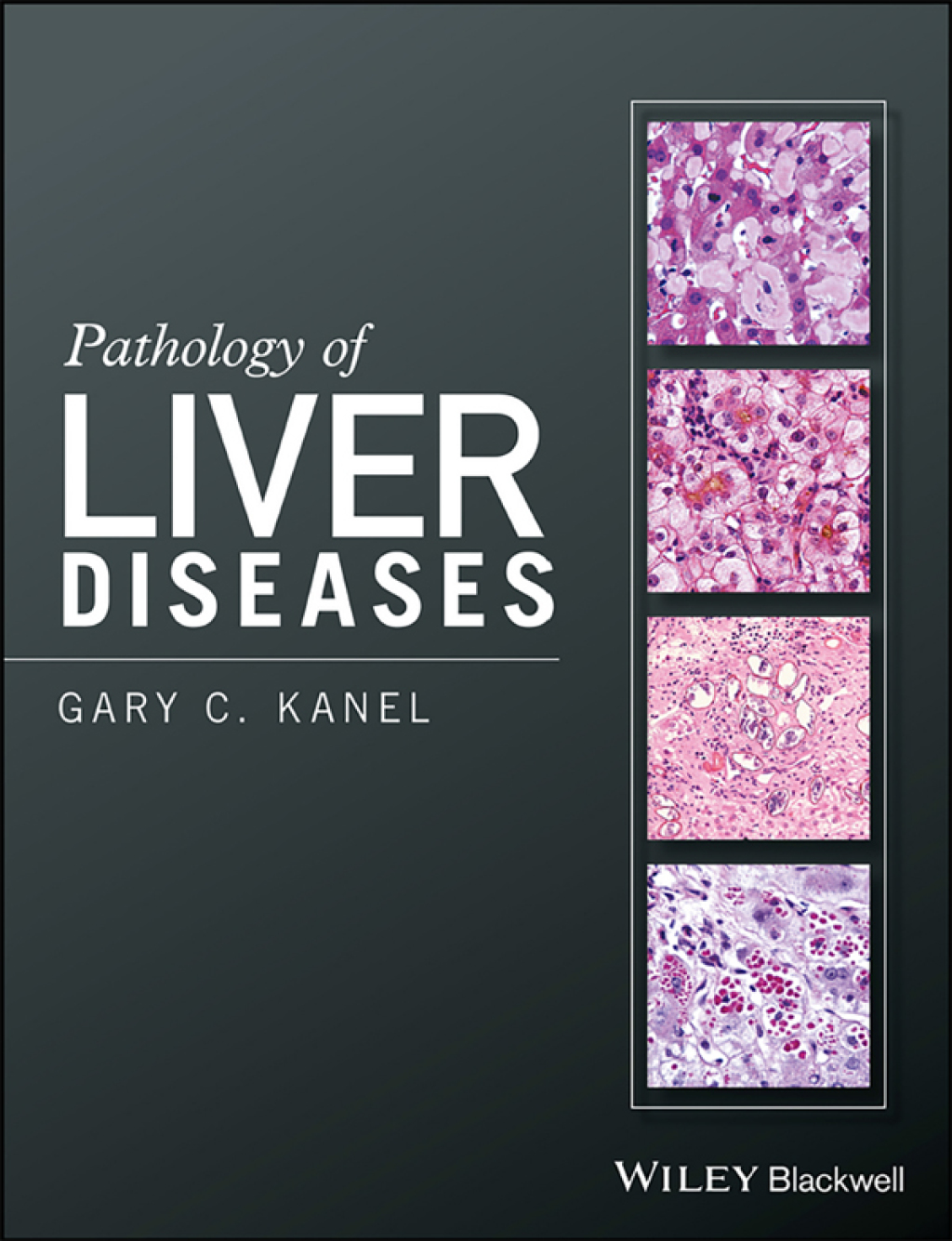 Pathology of Liver Diseases 1st Edition â€“ PDF/EPUB Version Downloadable