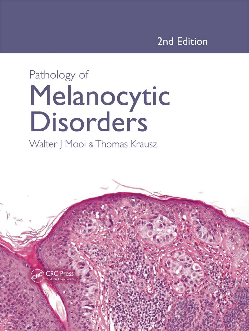 Pathology of Melanocytic Disorders 2ed 2nd Edition â€“ PDF/EPUB Version Downloadable