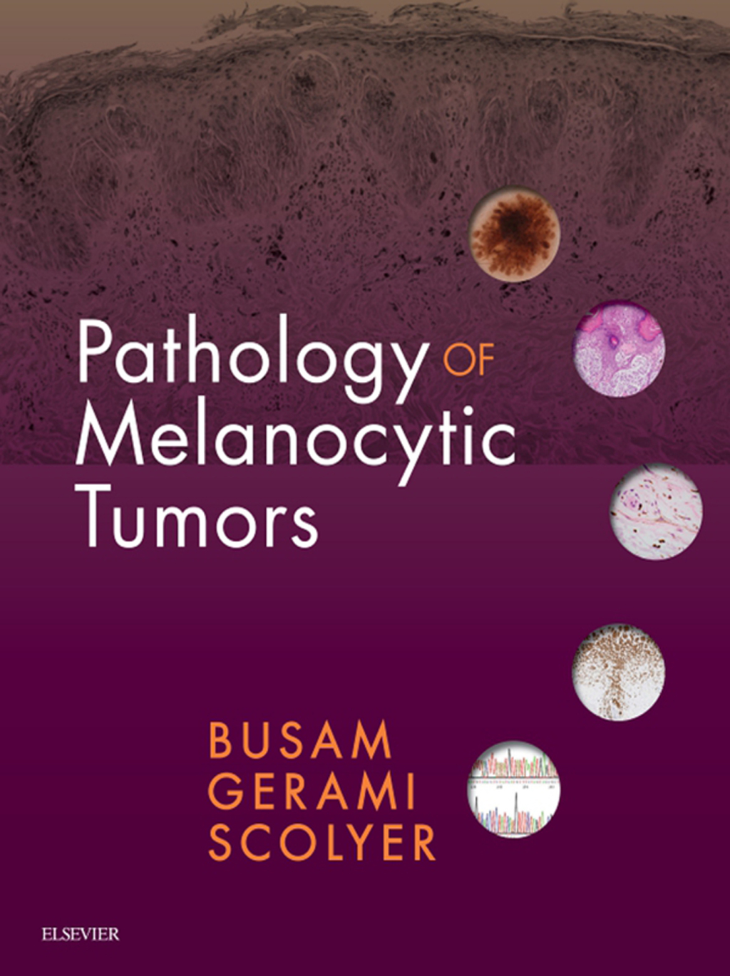 Pathology of Melanocytic Tumors E-Book  â€“ PDF/EPUB Version Downloadable