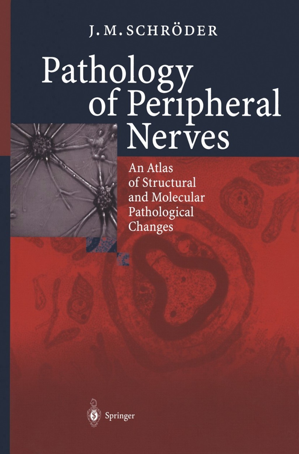 Pathology of Peripheral Nerves An Atlas of Structural and Molecular Pathological Changes  â€“ PDF/EPUB Version Downloadable