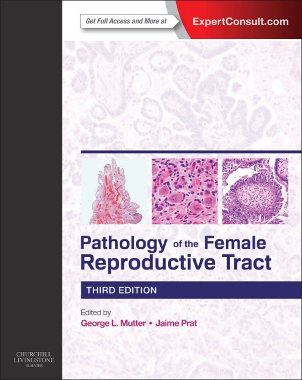 Pathology of the Female Reproductive Tract 3rd Edition â€“ PDF/EPUB Version Downloadable