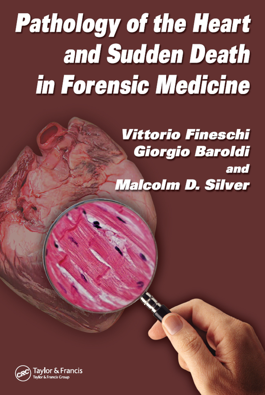 Pathology of the Heart and Sudden Death in Forensic Medicine 1st Edition â€“ PDF/EPUB Version Downloadable