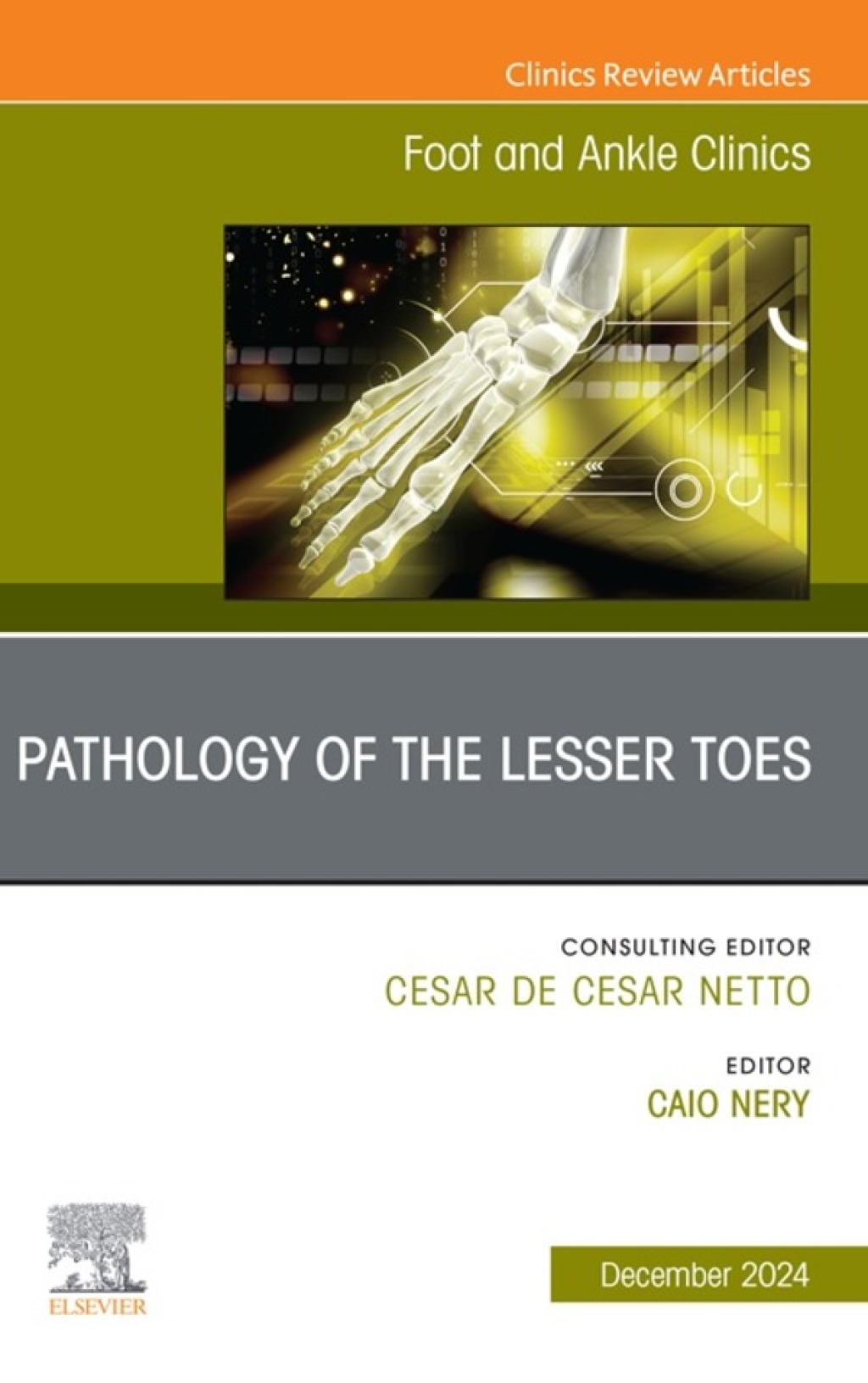 Pathology of the Lesser Toes, An issue of Foot and Ankle Clinics of North America  â€“ PDF/EPUB Version Downloadable
