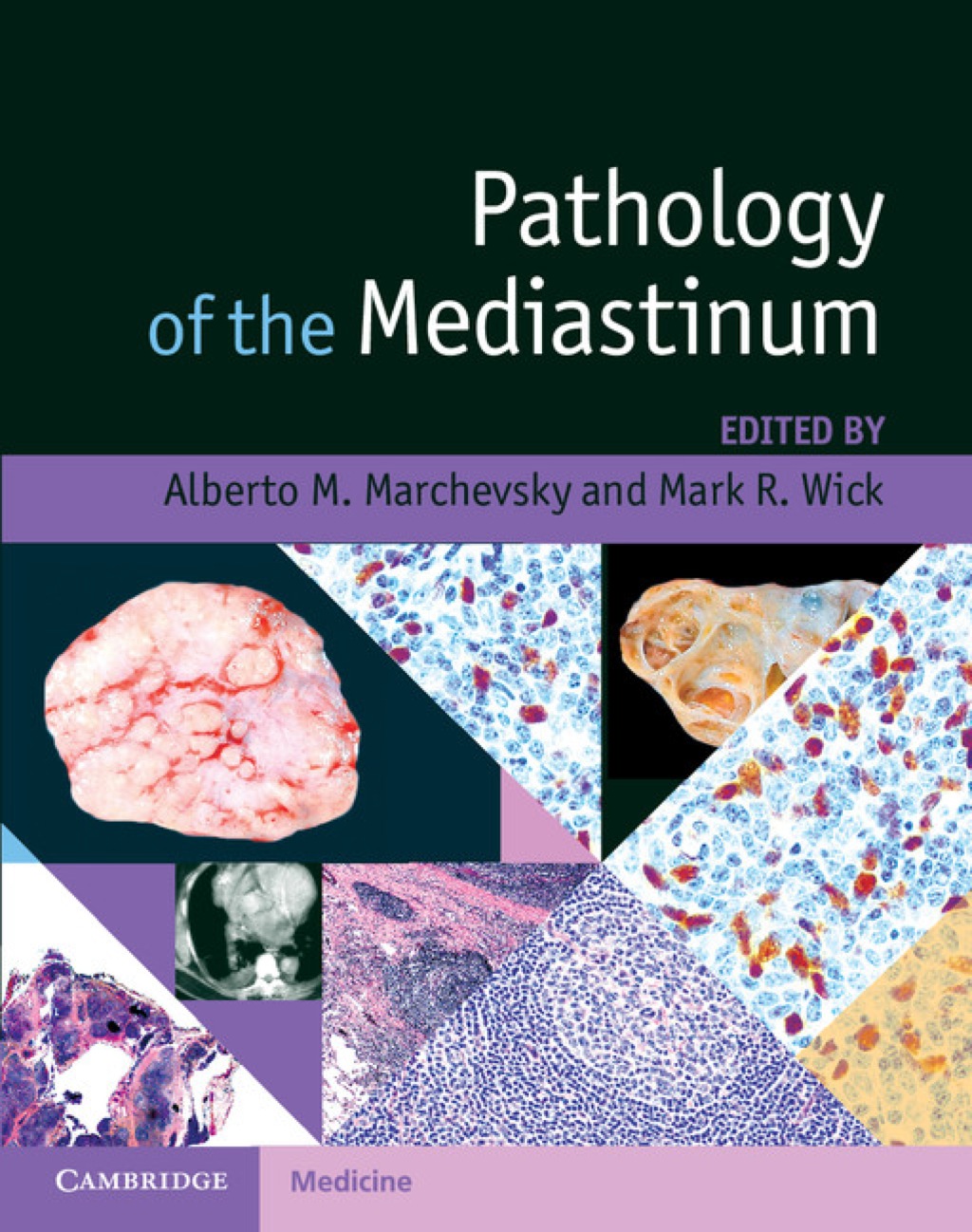 Pathology of the Mediastinum 1st Edition â€“ PDF/EPUB Version Downloadable