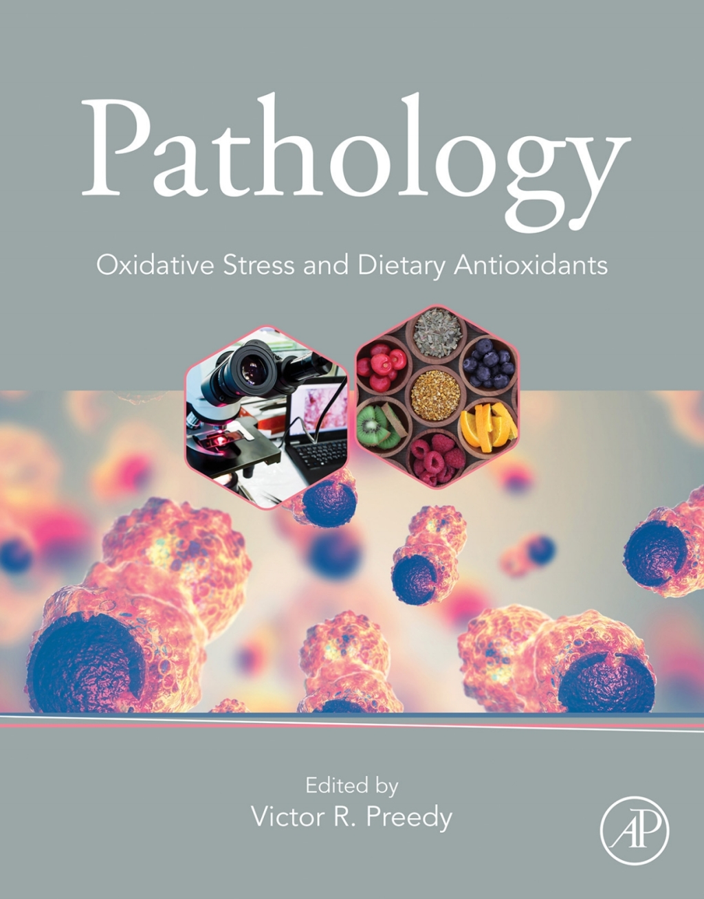 Pathology Oxidative Stress and Dietary Antioxidants 1st Edition â€“ PDF/EPUB Version Downloadable