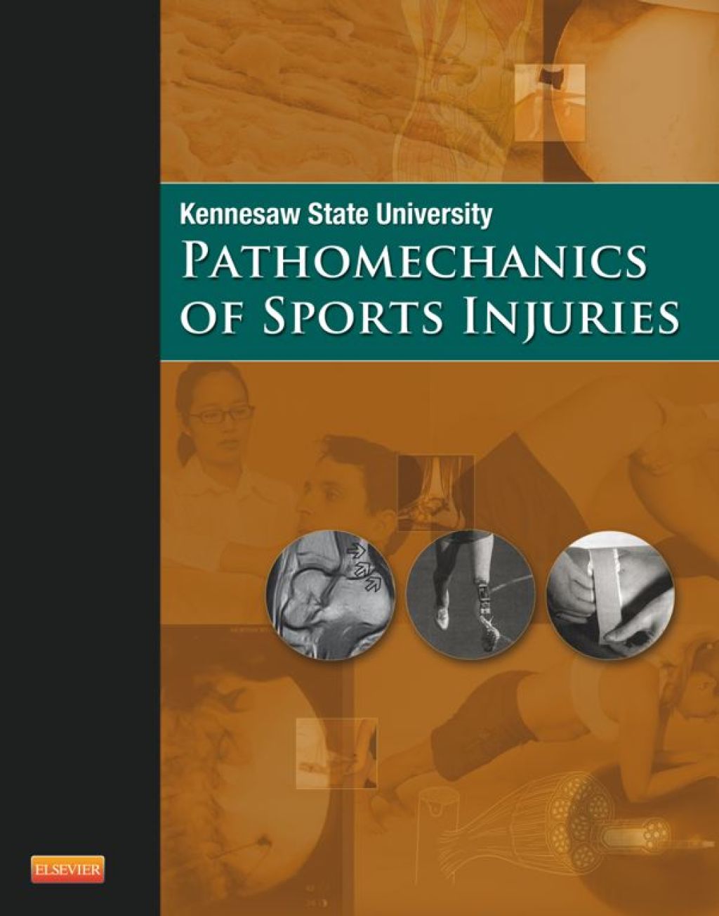Pathomechanics of Sports Injuries  â€“ PDF/EPUB Version Downloadable