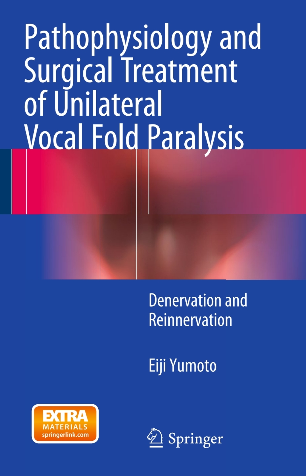 Pathophysiology and Surgical Treatment of Unilateral Vocal Fold Paralysis Denervation and Reinnervation  â€“ PDF/EPUB Version Downloadable