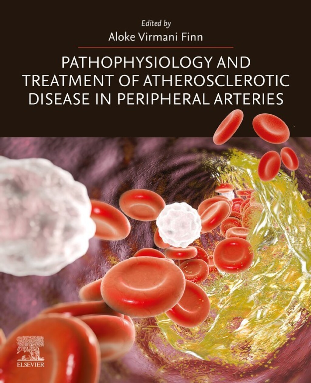 Pathophysiology and Treatment of Atherosclerotic Disease in Peripheral Arteries 1st Edition â€“ PDF/EPUB Version Downloadable