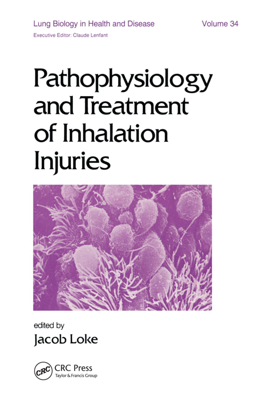 Pathophysiology and Treatment of Inhalation Injuries 1st Edition â€“ PDF/EPUB Version Downloadable