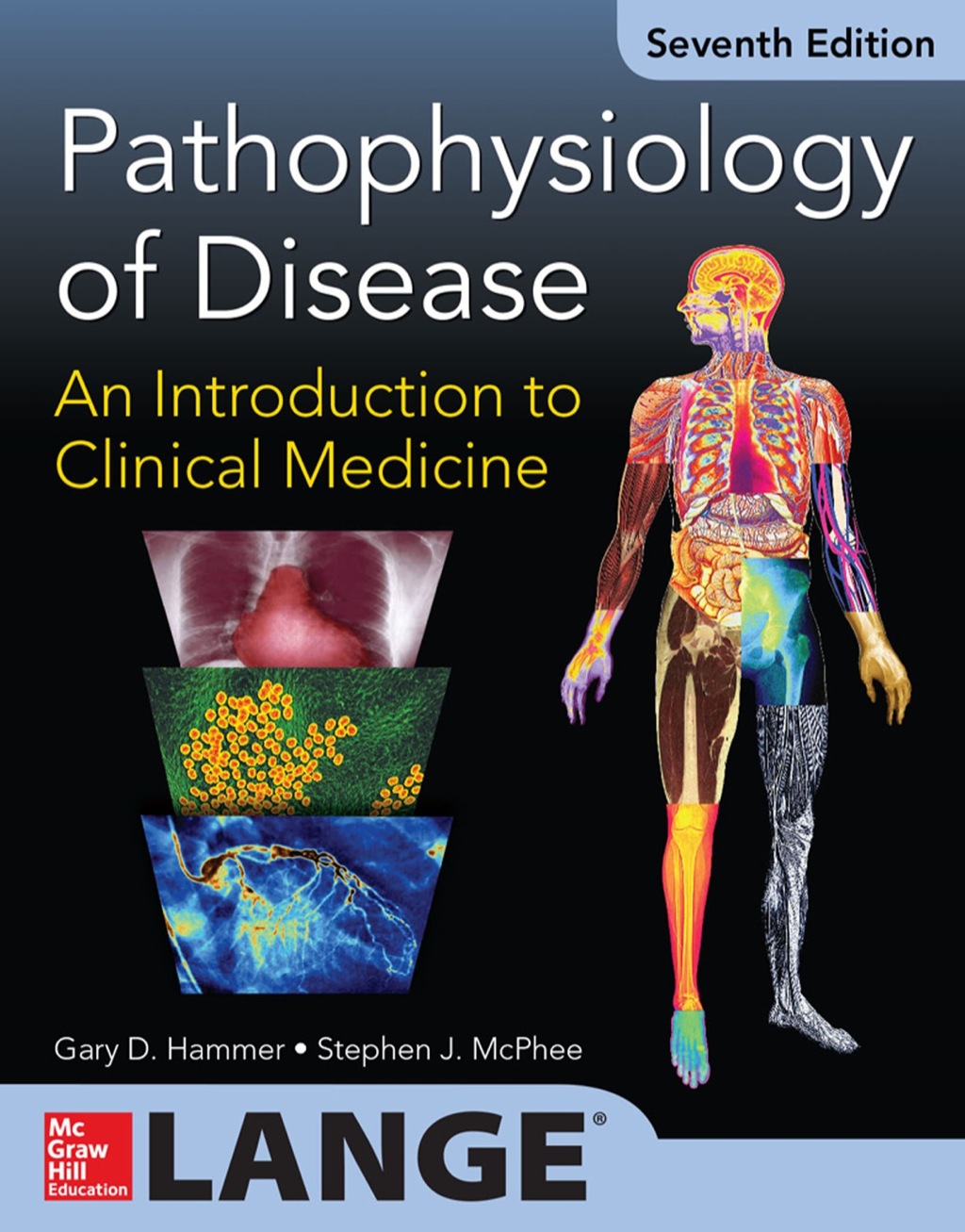 Pathophysiology of Disease: An Introduction to Clinical Medicine 7/E 7th Edition â€“ PDF/EPUB Version Downloadable