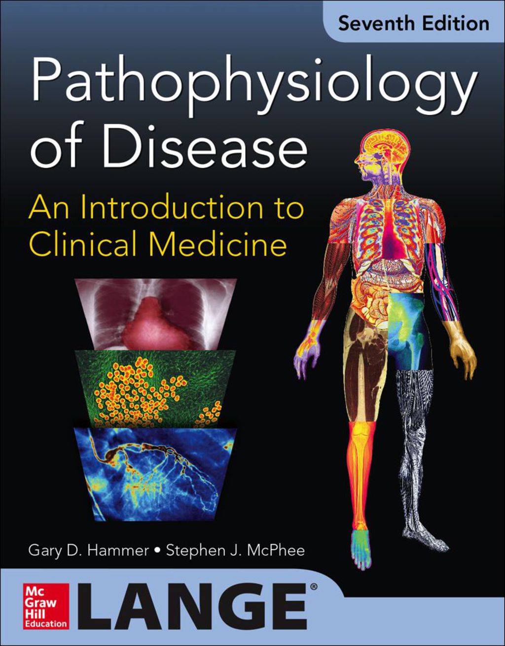 Pathophysiology of Disease: An Introduction to Clinical Medicine 7th Edition â€“ PDF/EPUB Version Downloadable