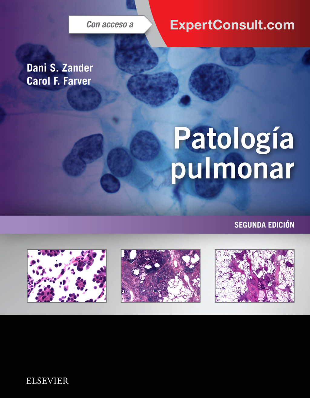 PatologÃ­a pulmonar 2nd Edition â€“ PDF/EPUB Version Downloadable