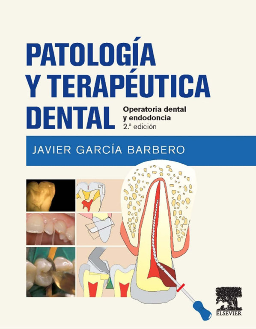 PatologÃ­a y terapÃ©utica dental Operatoria dental y endodoncia 2nd Edition â€“ PDF/EPUB Version Downloadable