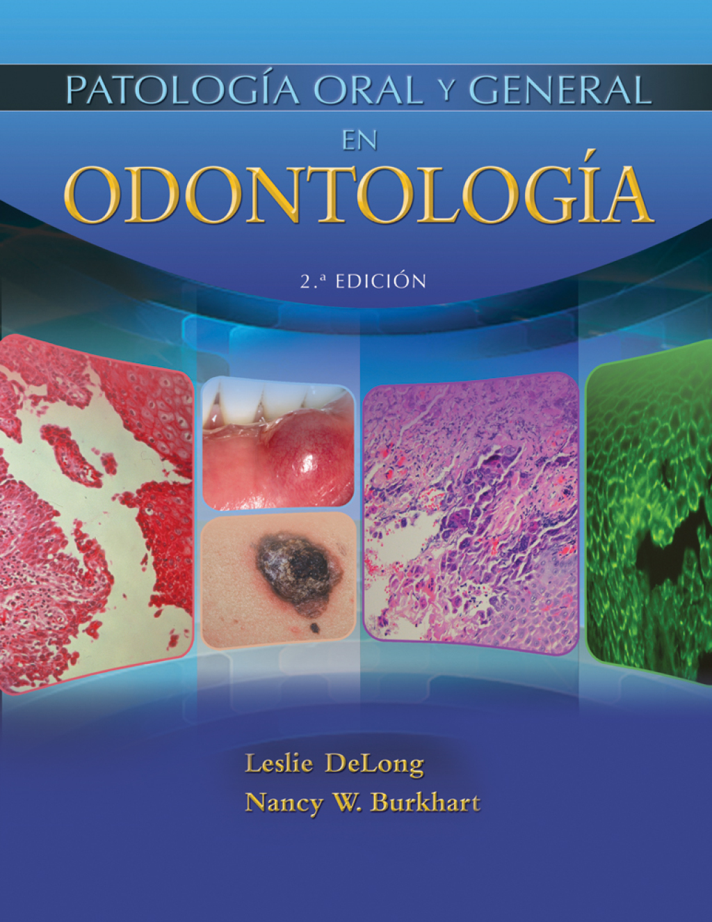 PATOLOGIA ORAL Y GENERAL EN ODON 2nd Edition â€“ PDF/EPUB Version Downloadable