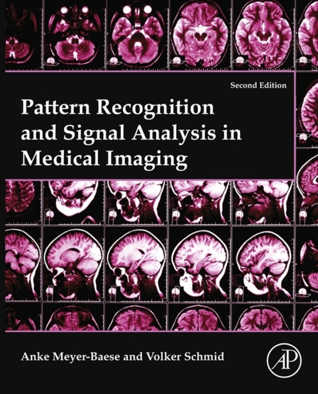 Pattern Recognition and Signal Analysis in Medical Imaging 2nd Edition â€“ PDF/EPUB Version Downloadable