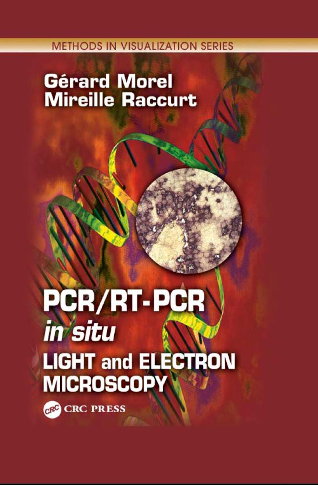PCR/RT- PCR in situ Light and Electron Microscopy 1st Edition â€“ PDF/EPUB Version Downloadable