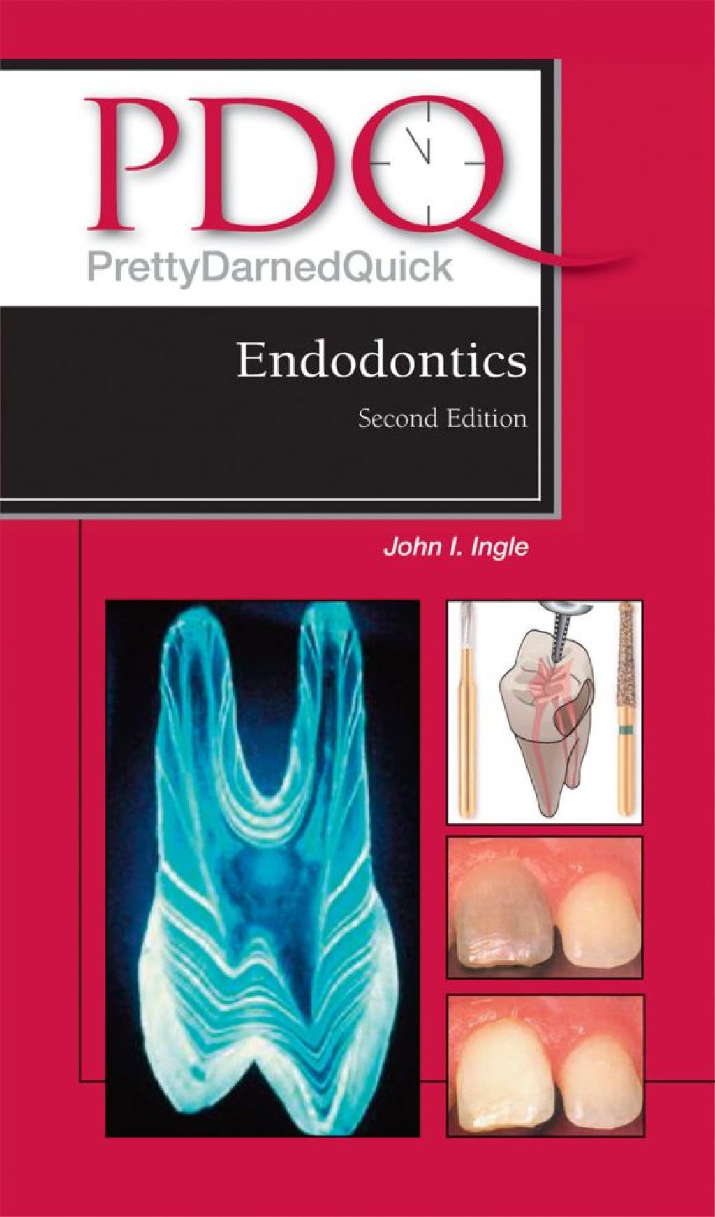PDQ Endodontics 2nd Edition â€“ PDF/EPUB Version Downloadable