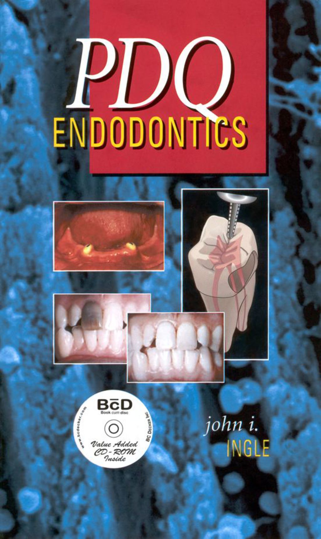 PDQ Endodontics 5th Edition â€“ PDF/EPUB Version Downloadable